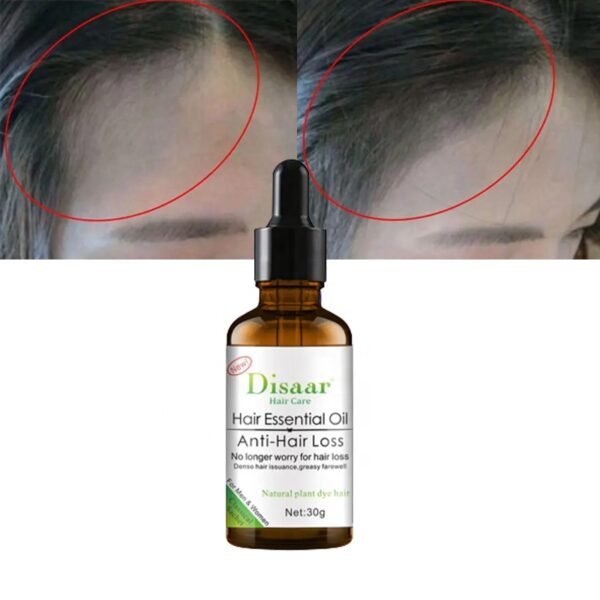 Disaar anti hair loss essential oil natural hair growth oil for hair loss
