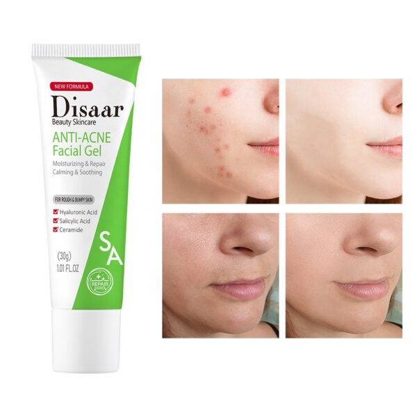 Disaar Salicylic acid ceramide anti acne facial gel acne removal gel natural acne repair cream