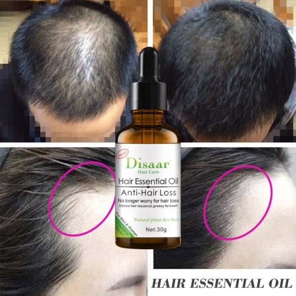 Disaar anti hair loss essential oil natural hair growth oil for hair loss - Image 3