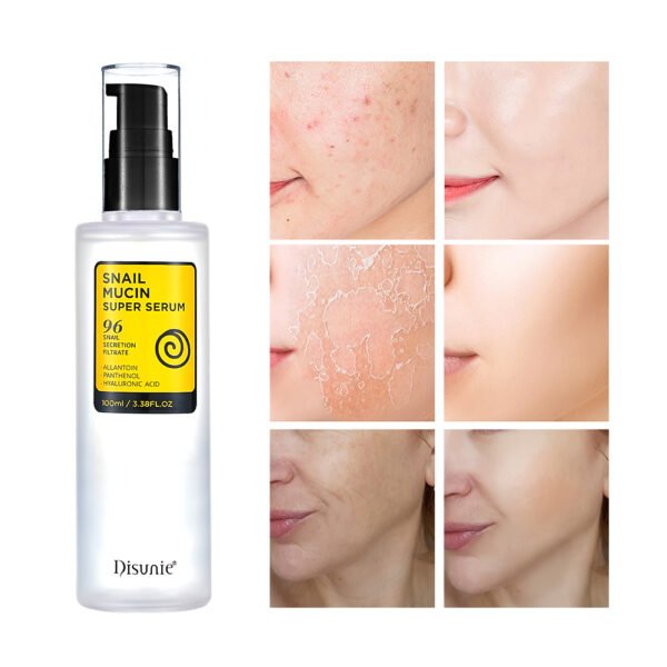 Best 96% Snail Secretion Filtrate Extract Skin Care Face Serum Oem Hyaluronic Acid Dark Spots Skin Repair Serum For Face