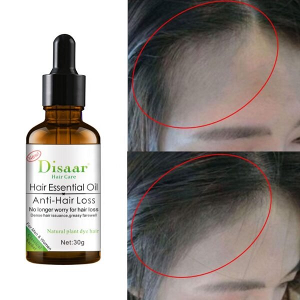 Disaar anti hair loss essential oil natural hair growth oil for hair loss - Image 4