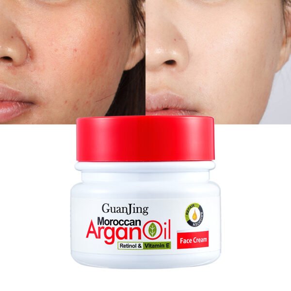 Skin Bleaching Lightening Cream Skin Day and Night Face Cream in Saudi Arabia for The Freckles Skin Face and Body