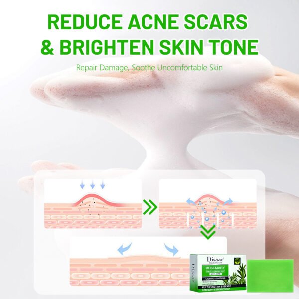 Disaar Best Oil Control Rosemary Soap Centella Essence Soap Natural Plant Face Body Cleaning Brightening Moisturizing Repair Acne Soap - Image 5