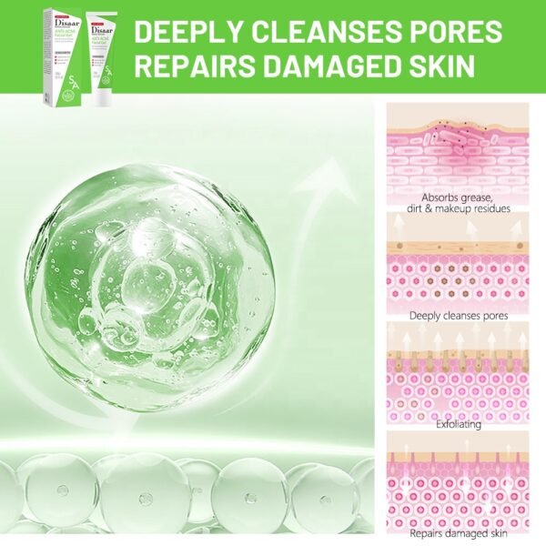 Disaar Salicylic acid ceramide anti acne facial gel acne removal gel natural acne repair cream - Image 5