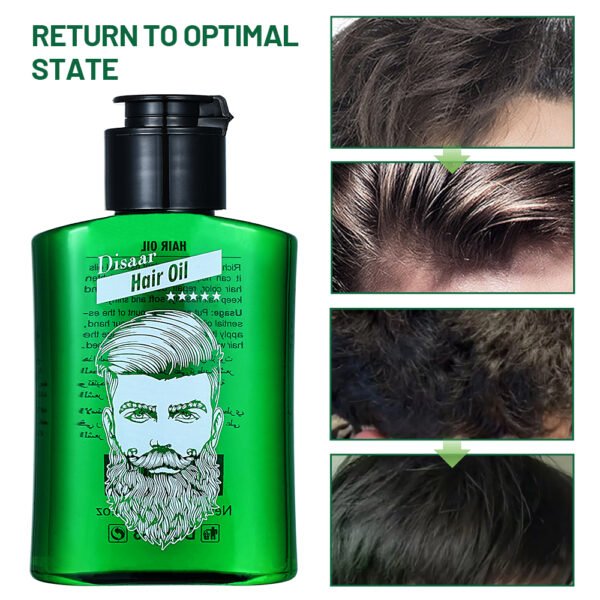 Natural Hair Care Oil Regrowth Treatment Products Hair Growth Men Essential Oil (new) - Image 6