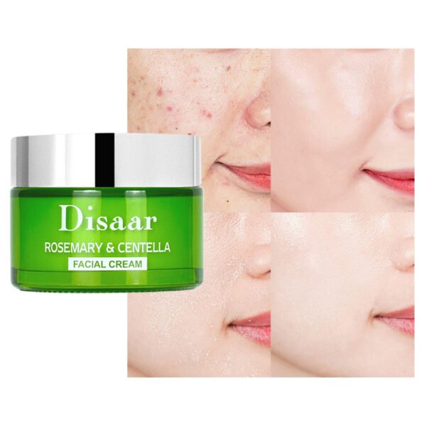Disaar Natural Rosemary & Centella Face Cream Niacinamide Skin Lightening Moisturizing Dark Spot Acne Damage Skin Repair Face Cream - Image 7